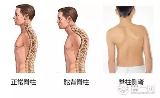 人体脊椎效果图